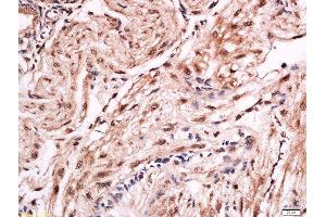 Formalin-fixed and paraffin embedded rat placenta labeled with Anti-FOXF1 Polyclonal Antibody, Unconjugated  at 1:200 followed by conjugation to the secondary antibody and DAB staining. (FOXF1 antibody  (AA 285-379))