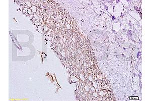 Formalin-fixed and paraffin embedded rat ovary tissue labeled with Anti-Inhibin Alpha Polyclonal Antibody, Unconjugated (ABIN736656) at 1:200, followed by conjugation to the secondary antibody and DAB staining