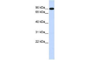 Human Muscle; WB Suggested Anti-ZXDA Antibody Titration: 0. (ZXDA antibody  (Middle Region))