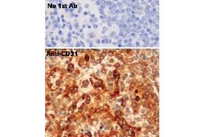 Immunohistochemistry (IHC) image for anti-Platelet/endothelial Cell Adhesion Molecule (PECAM1) (C-Term) antibody (ABIN6254202)