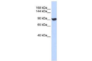 Alpha Actinin 1 antibody used at 1 ug/ml to detect target protein. (ACTN1 antibody  (N-Term))