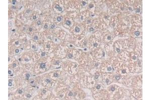 Detection of MIB2 in Human Liver Tissue using Polyclonal Antibody to Mindbomb Homolog 2 (MIB2) (MIB2 antibody  (AA 687-930))