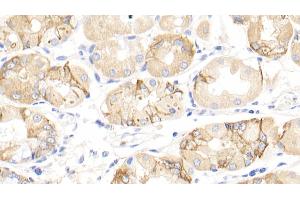 Detection of INHbA in Human Stomach Tissue using Polyclonal Antibody to Inhibin Beta A (INHbA) (INHBA antibody  (AA 311-426))