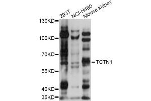 Western blot analysis of extracts of various cell lines, using TCTN1 antibody (ABIN6292813) at 1:1000 dilution. (TCTN1 antibody)