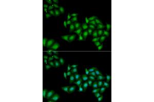 Immunofluorescence analysis of HeLa cells using DDX1 antibody (ABIN5973950). (DDX1 antibody)