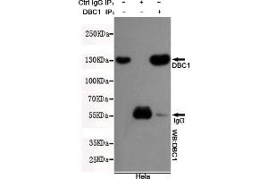 Immunoprecipitation analysis of Hela cell lysates using DBC1 mouse mAb. (DBC1 antibody)