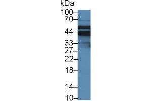 Detection of SLC9A3R2 in Porcine Liver lysate using Polyclonal Antibody to Sodium Hydrogen Exchange Regulatory Cofactor 2 (SLC9A3R2) (Sodium Hydrogen Exchange Regulatory Cofactor 2 (AA 56-337) antibody)