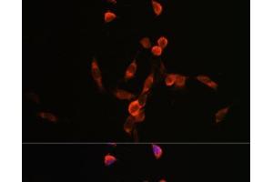 Immunofluorescence analysis of NIH/3T3 cells using PIK3CA Polyclonal Antibody at dilution of 1:100. (PIK3CA antibody)