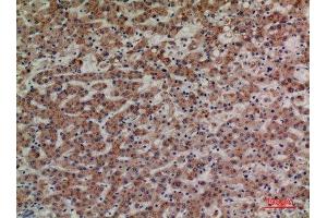 Immunohistochemistry (IHC) analysis of paraffin-embedded Human Liver, antibody was diluted at 1:100. (LILRA4 antibody  (Internal Region))