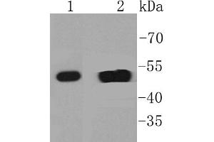 Lane 1: A431 Cell lysates, Lane 2: Human skin lysates, probed with Cytokeratin 14 (2F11) Monoclonal Antibody  at 1:1000 overnight at 4˚C.