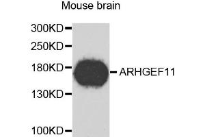 Western blot analysis of extracts of mouse brain, using ARHGEF11 antibody.