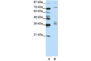 WB Suggested Anti-AKAP9  Antibody Titration: 1. (AKAP9 antibody  (N-Term))