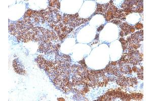 Formalin-fixed, paraffin-embedded human Parathyroid stained with PTH Mouse Monoclonal Antibody (SPM604). (PTH antibody  (AA 1-34))