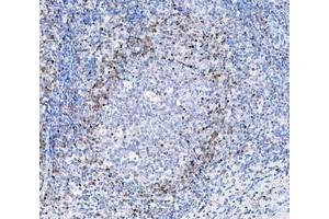 IHC analysis of ADK using anti-ADK antibody (ABIN4886430). (ADK antibody  (AA 165-351))