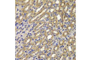 Immunohistochemistry of paraffin-embedded mouse kidney using CCNA2 antibody (ABIN5995369) at dilution of 1/100 (40x lens). (Cyclin A antibody)