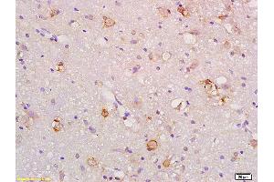 Formalin-fixed and paraffin embedded rat brain labeled with Anti-Gas1 Polyclonal Antibody, Unconjugated (ABIN872751) at 1:200 followed by conjugation to the secondary antibody and DAB staining.