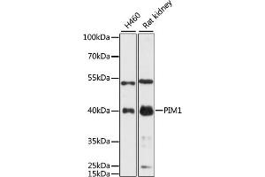 Western blot analysis of extracts of various cell lines, using PIM1 antibody (ABIN6128456, ABIN6145654, ABIN6145656 and ABIN6218499) at 1:3000 dilution. (PIM1 antibody  (AA 1-313))