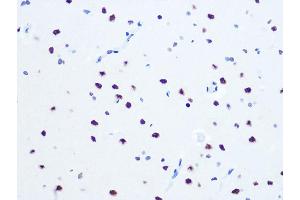 Immunohistochemistry of paraffin-embedded rat brain using DHX9/DHX9/RNA Helicase A Rabbit mAb (ABIN7265747) at dilution of 1:100 (40x lens). (DHX9 antibody)