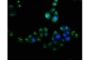 Immunofluorescence staining of Hela cells with ABIN7175336 at 1:100, counter-stained with DAPI. (VPS25 antibody  (AA 1-176))