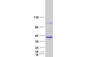 Validation with Western Blot (HSD17B2 Protein (Myc-DYKDDDDK Tag))
