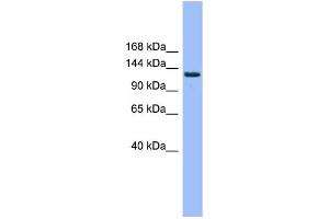 WB Suggested Anti-EVI1 Antibody Titration: 0. (MECOM antibody  (Middle Region))
