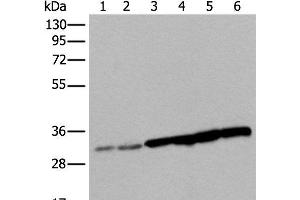 Western blot analysis of 293T cell Hela cell HEPG2 cell and A549 cell lysates using SNRPA Polyclonal Antibody at dilution of 1:250 (SNRPA1 antibody)