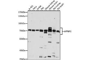 Western blot analysis of extracts of various cell lines, using  antibody (ABIN7265579) at 1:1000 dilution. (APPBP2 antibody  (AA 386-585))