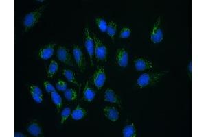 Flow cytometry testing of human HeLa cells with CLPX antibody at 1ug/10^6 cells (blocked with goat sera) (CLPX antibody)