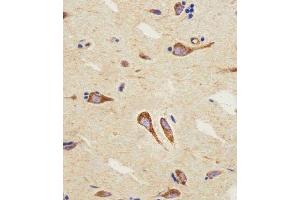 Immunohistochemical analysis of paraffin-embedded H.