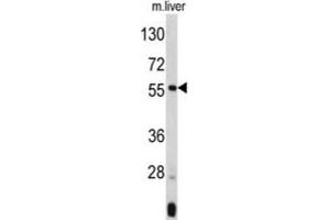 Western Blotting (WB) image for anti-Angiopoietin-Like 3 (ANGPTL3) antibody (ABIN3002764) (ANGPTL3 antibody)