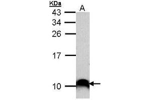 WB Image Sample (30 ug of whole cell lysate) A: A431 , 15% SDS PAGE antibody diluted at 1:1000 (COX7B2 antibody)