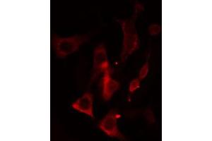 ABIN6274644 staining HeLa cells by IF/ICC. (CYP2A13 antibody)