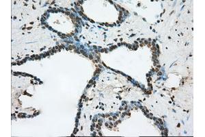 Immunohistochemical staining of paraffin-embedded prostate tissue using anti-ERCC1 mouse monoclonal antibody.
