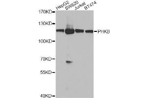 Western blot analysis of extracts of various cell lines, using PHKB antibody (ABIN5974480) at 1/1000 dilution.