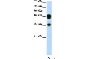 Western Blotting (WB) image for anti-Forkhead Box A1 (FOXA1) antibody (ABIN2460520)