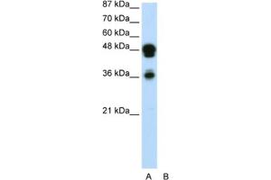 Western Blotting (WB) image for anti-Forkhead Box A1 (FOXA1) antibody (ABIN2460520) (FOXA1 antibody)