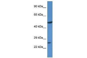Western Blot showing KLF17 antibody used at a concentration of 1.