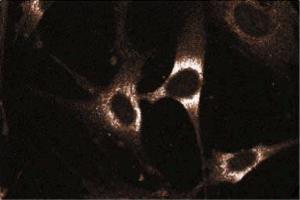 Immunoflourescent staining on WI-38 cells. (RAB5 antibody  (AA 1-215))