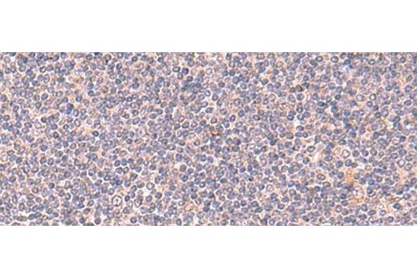 MANSC1 antibody