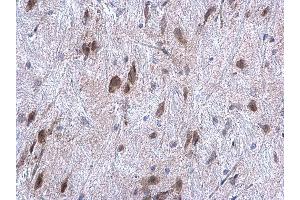 Immunohistochemistry (IHC) image for anti-Hypoxia Up Regulated 1 (HYOU1) (C-Term) antibody (ABIN2855339)