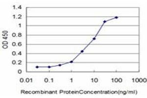 Detection limit for recombinant GST tagged FLT4 is approximately 0. (FLT4 antibody  (AA 34-133))