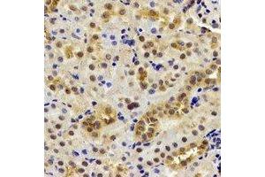 Immunohistochemical analysis of DDX1 staining in mouse kidney formalin fixed paraffin embedded tissue section. (DDX1 antibody)