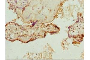 Immunohistochemistry of paraffin-embedded human placenta tissue using ABIN7176144 at dilution of 1:100