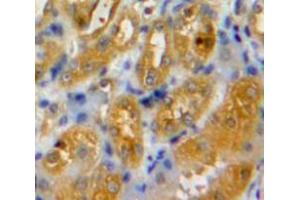 Used in DAB staining on fromalin fixed paraffin-embedded Kidney tissue (IRF6 antibody  (AA 150-445))