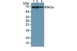 Western blot analysis of (1) Human 293T Cells, (2) Human HepG2 Cells and (3) Human Placenta Tissue. (KEAP1 antibody  (AA 327-624))