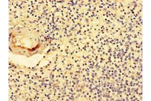 Immunohistochemistry of paraffin-embedded human spleen tissue using ABIN7161893 at dilution of 1:100 (NR1D1 antibody  (AA 246-558))