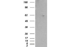 HEK293 overexpressing RXRB (ABIN5363696) and probed with ABIN185296 (mock transfection in first lane). (Retinoid X Receptor beta antibody  (AA 70-83))