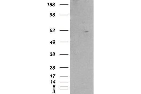 Retinoid X Receptor beta antibody  (AA 70-83)