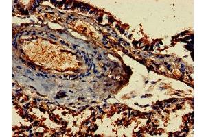 Immunohistochemistry of paraffin-embedded human lung tissue using ABIN7155188 at dilution of 1:100 (FCER1G antibody  (AA 19-86))