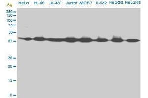 AHCY monoclonal antibody (M09), clone M2. (AHCY antibody  (AA 1-432))